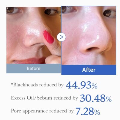 Medicube Zero Pore - Lenços Tonalizadores (70 un) - Imagem 4