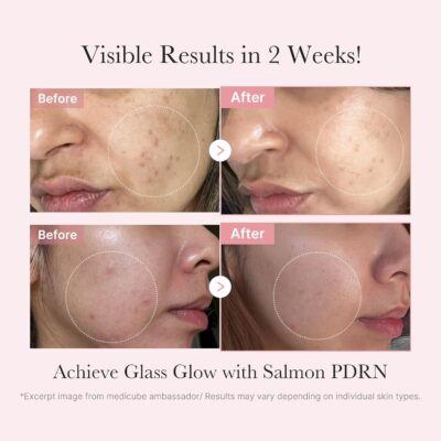 Medicube Salmon DNA PDRN Kit | Mini Skincare Set with Toner, Serum & Sheet Mask - Imagem 2