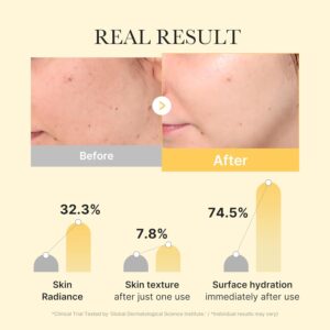 Medicube Pacote com 4 Kojic Acid Turmeric Brightening Gold Jelly Gel Máscara facial - Imagem 2